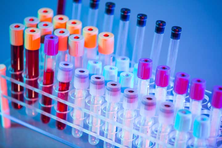 bloodtubes