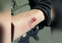 Madison Man Charged With Assaulting ICE Officers During Protest