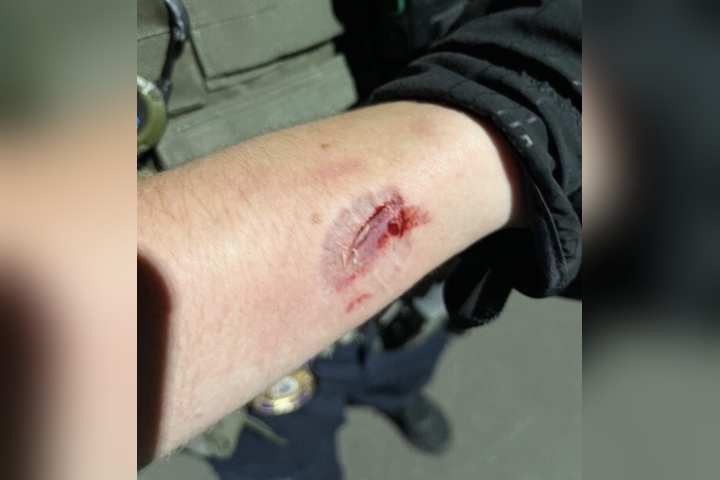 Madison Man Charged With Assaulting ICE Officers During Protest